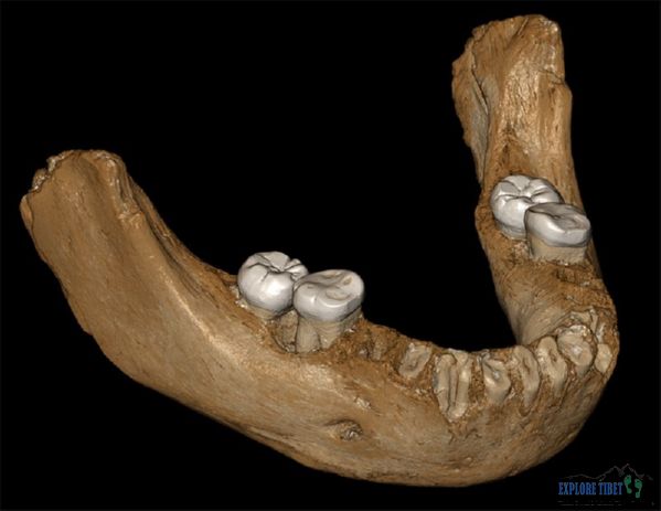 A virtual reconstruction of the Tibetan jaw in which an adhering crust was digitally removed.